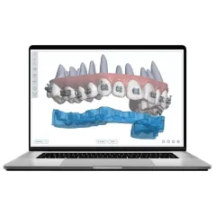 An example of a digital photograph used for orthodontic treatment in San Antonio, TX.