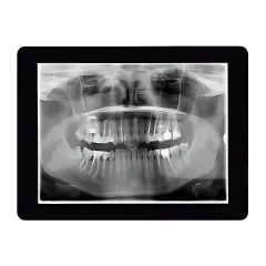 Digital x-rays are used by Hulme Orthodontics to diagnose and treat orthodontic concerns in San Antonio, TX.